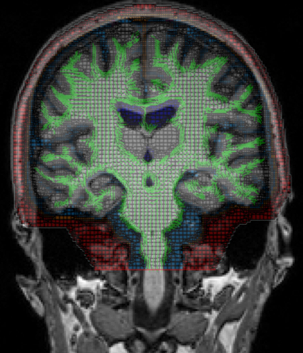 Head Trauma Research